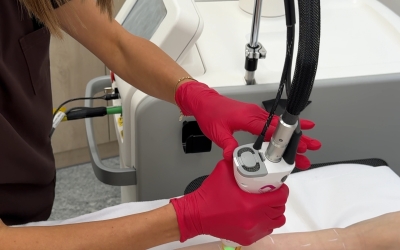 Wellsens - Depilacja laserowa aleksandrytowa